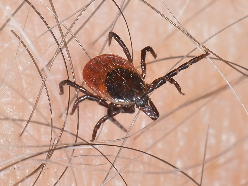 Una zecca sul braccio:  Ixodes cfr. ricinus, femmina